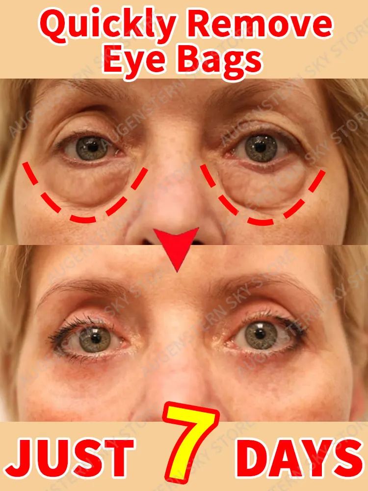 

Eye Cream Removal Dark Circles & Eye bag