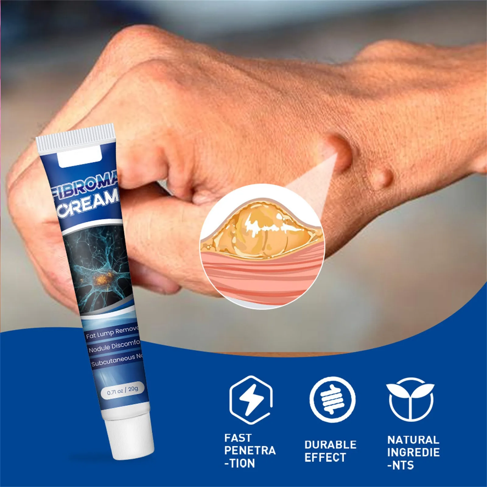 Reduce Lipoma Gel In Organic Material Fast Absorption Reduction Of Inflammation Moisturizing Effect skin care products lipoma removal ointment