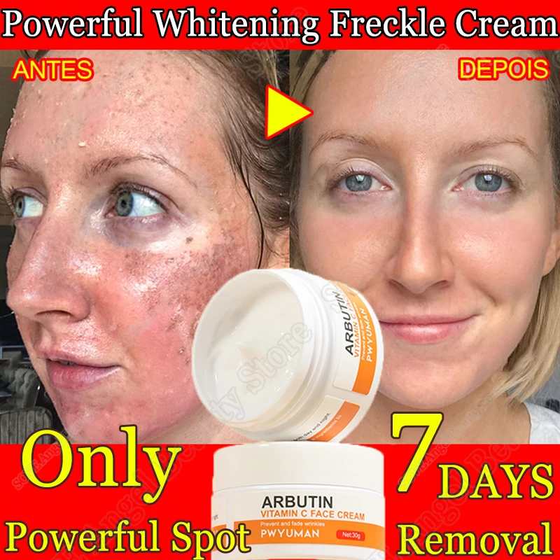 

Vitamin C Whitening Face Cream Remover Dark Spots Freckle Brightening Cream Moisturizing Firming Facial Beauty Health Skin Care