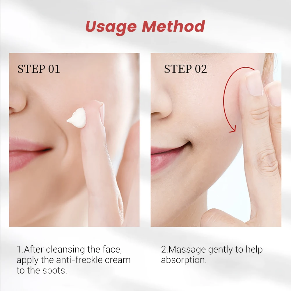 Freckle Whitening Cream Removal Pigment Melanin Correcting Beauty Face Skin Care Nourishing Brighten Fade Dark Spot Corrector 3