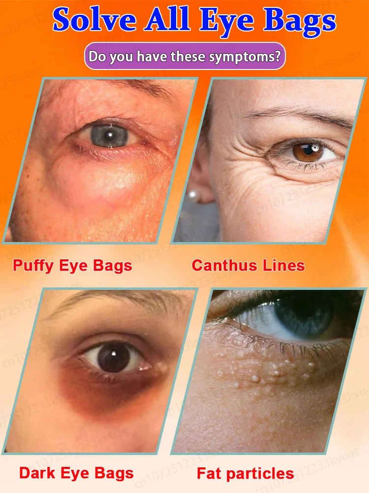 Natural anti-puffing eye cream that eliminates puffiness and dark circles contains centella asiatica and aloe vera extracts