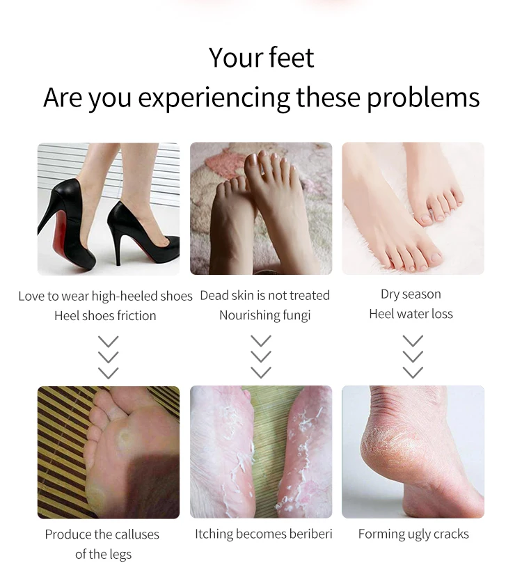 Rechargeable Electric Foot File Pedicure Tool Foot Sander IPX7 Waterproof 2 Speeds Eliminate Feet Dead Skin and Calluses Remover electric foot grinder electric foot file electric foot callus remover