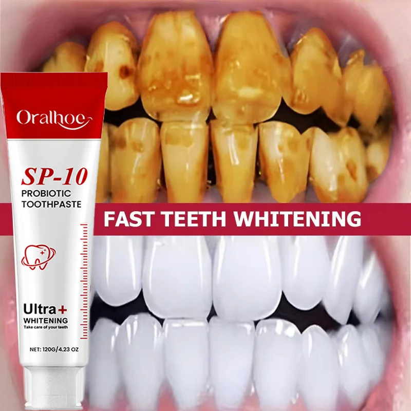 SP-10 Probiotic Toothpaste Remove Plaque Stains Whiten Tooth Fresh Breath Oral Hygiene Clean Teeth Care Management Product 120g