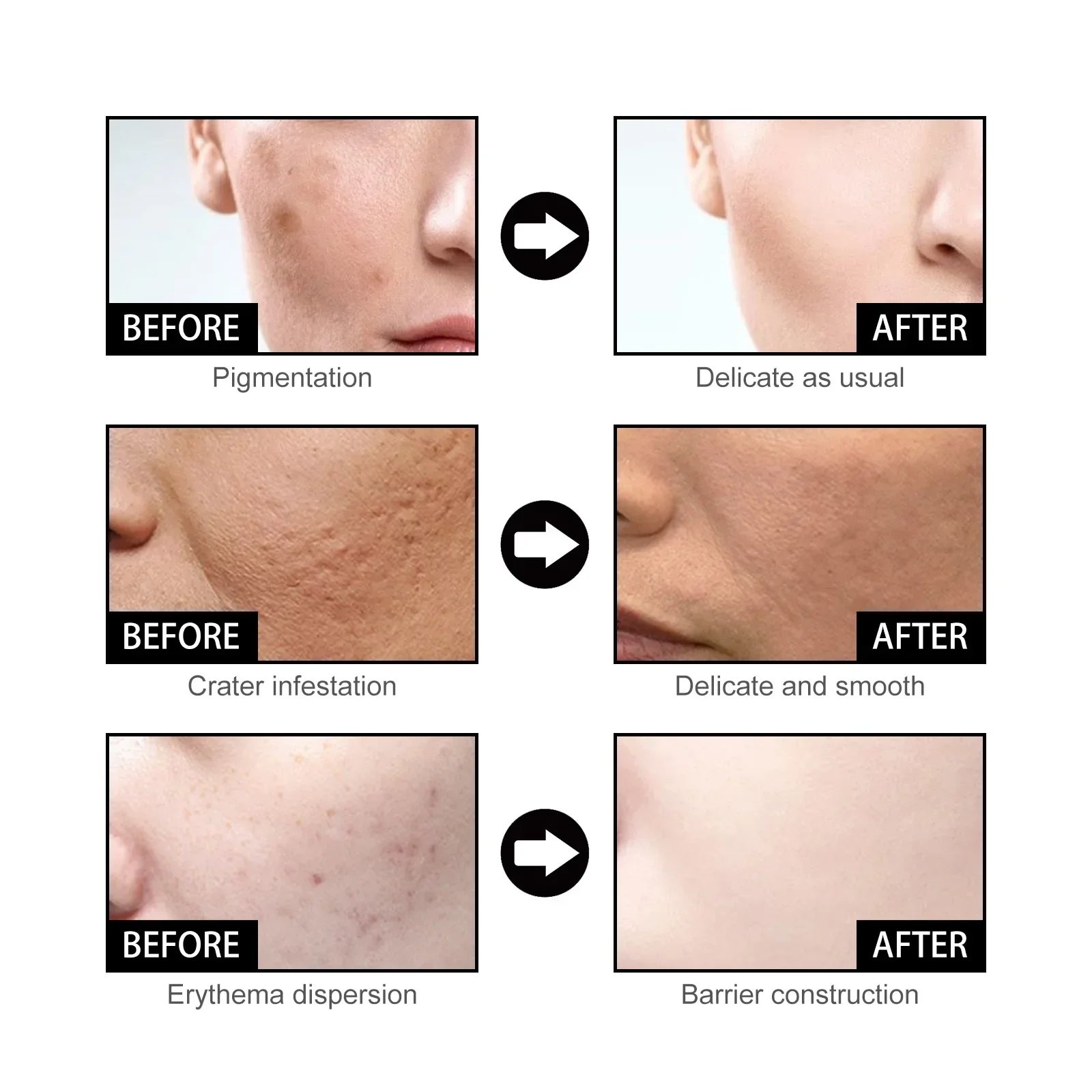 Niacinamide Serum for Acne and Dark Spots Hyaluronic Acid Anti Aging Face Serum Pore Shrinking Hydrating Moisturizing 50ml facial serum essence