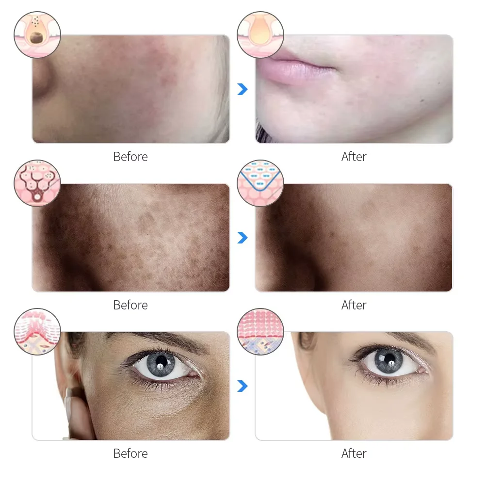 7 Colors LED Face Beauty Machine Photon Facial Mask Skin Tighten Rejuvenation Facial Neck Mask Rechargeable facial neck mask led facial mask facial machine