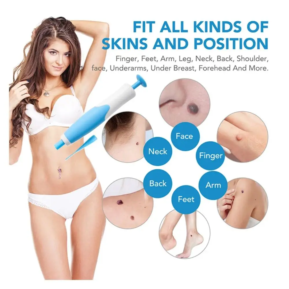 Dual Head Wart Removal Kit Flat Plantar Wart Remover Liquid Pen Flesh Mole Remover Chicken Eye skin tag removal tool skin tag removal pen