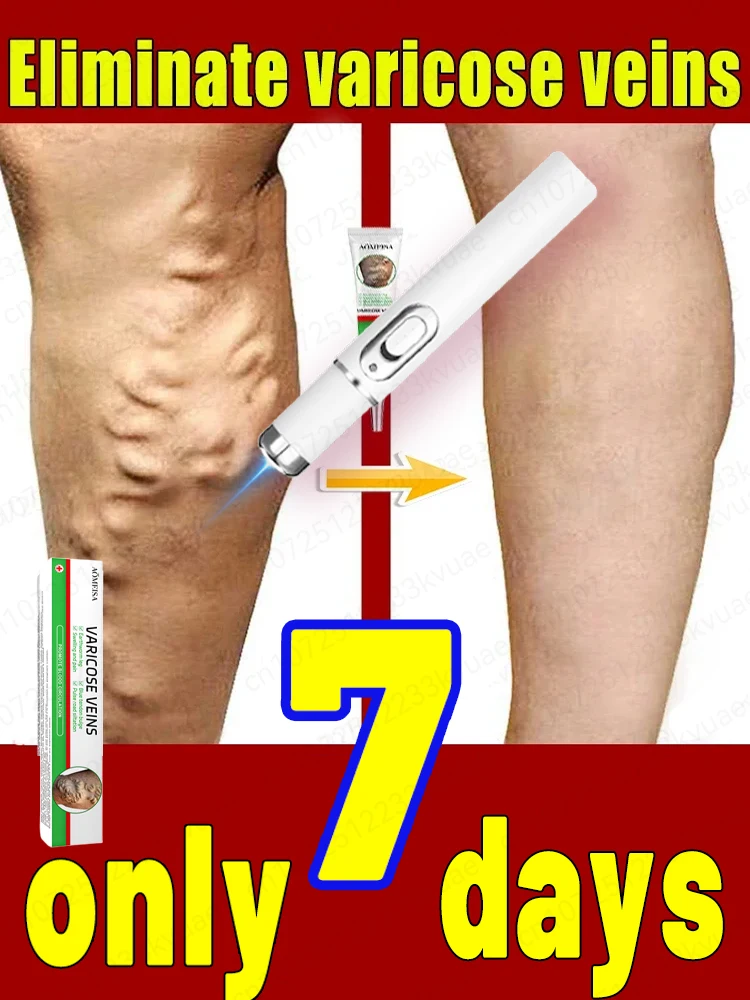 Powerful laser therapy for medium to high varicose veins, relieving patient pain and improving circulation