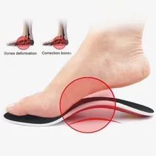 

Varus Orthotic Insole for Legs Correction Orthopedic Shoes Pad Plantar Fasciitis Arch Support Flat Foot Care Pain Relief