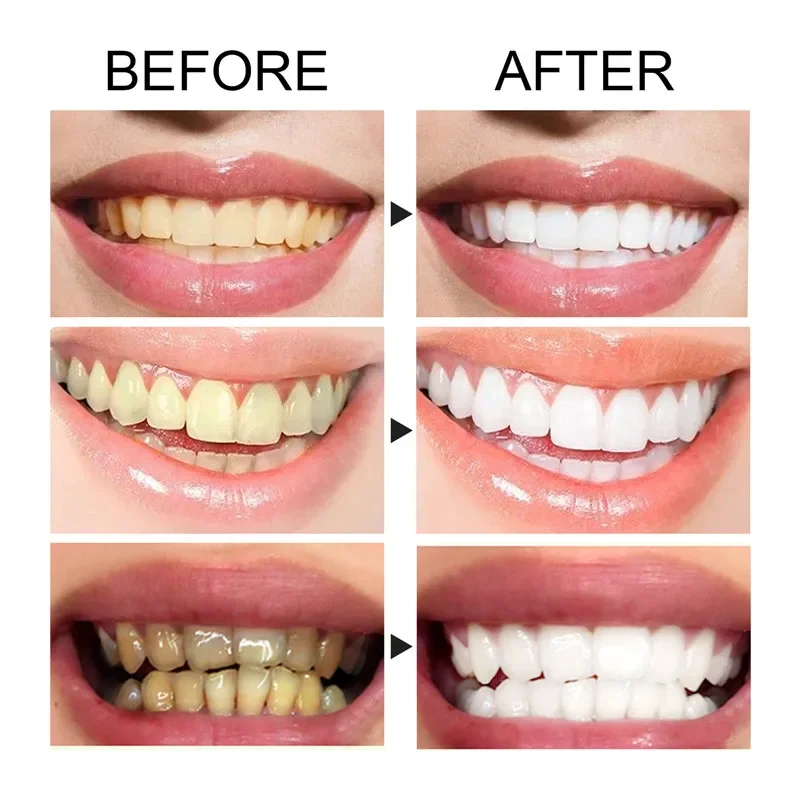 Sdatter 60Ml Sbiancamento Dei Denti Mousse Per La Pulizia Essenza Per La Cura Dei Denti Freshens Breath Remove Tooth Stain Gingival Repair Carie Oral