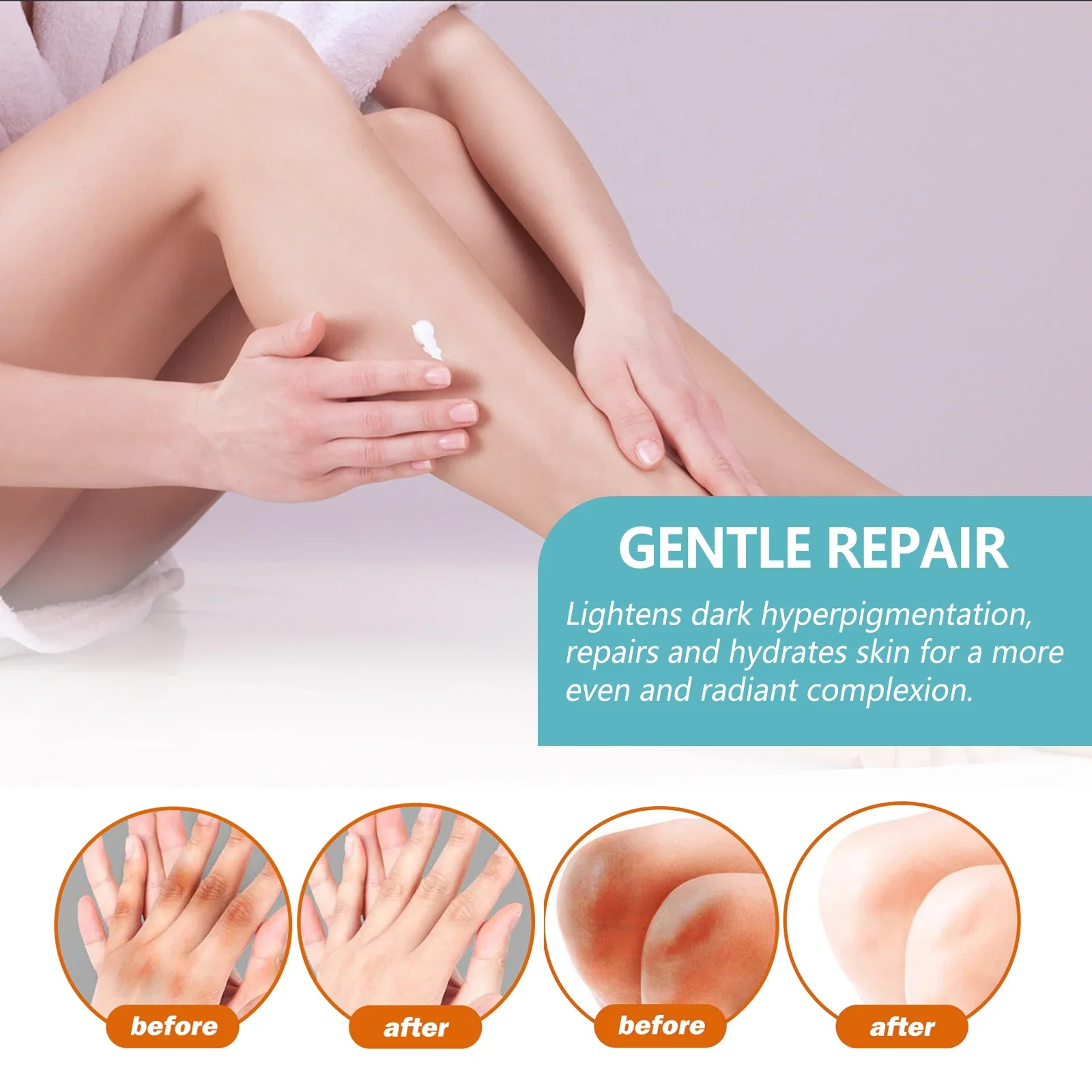 Black Acanthoderma Moisturizing Repair Cream Brightening Armpits Arms Knees Lightening Emulsion Brighten Skin Body Care Cream 5