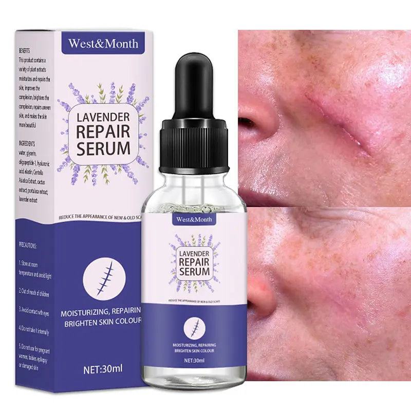 Scar Repairing Serum Stretch Marks Removal Liquid Lighten Blemish Acne
