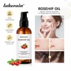 Organic Rosehip Oil Rose Hips Face Oils 30ml Fast-Absorbing For Anti-aging Scar Treatment Skin Care Moisturizer Face Oil 1