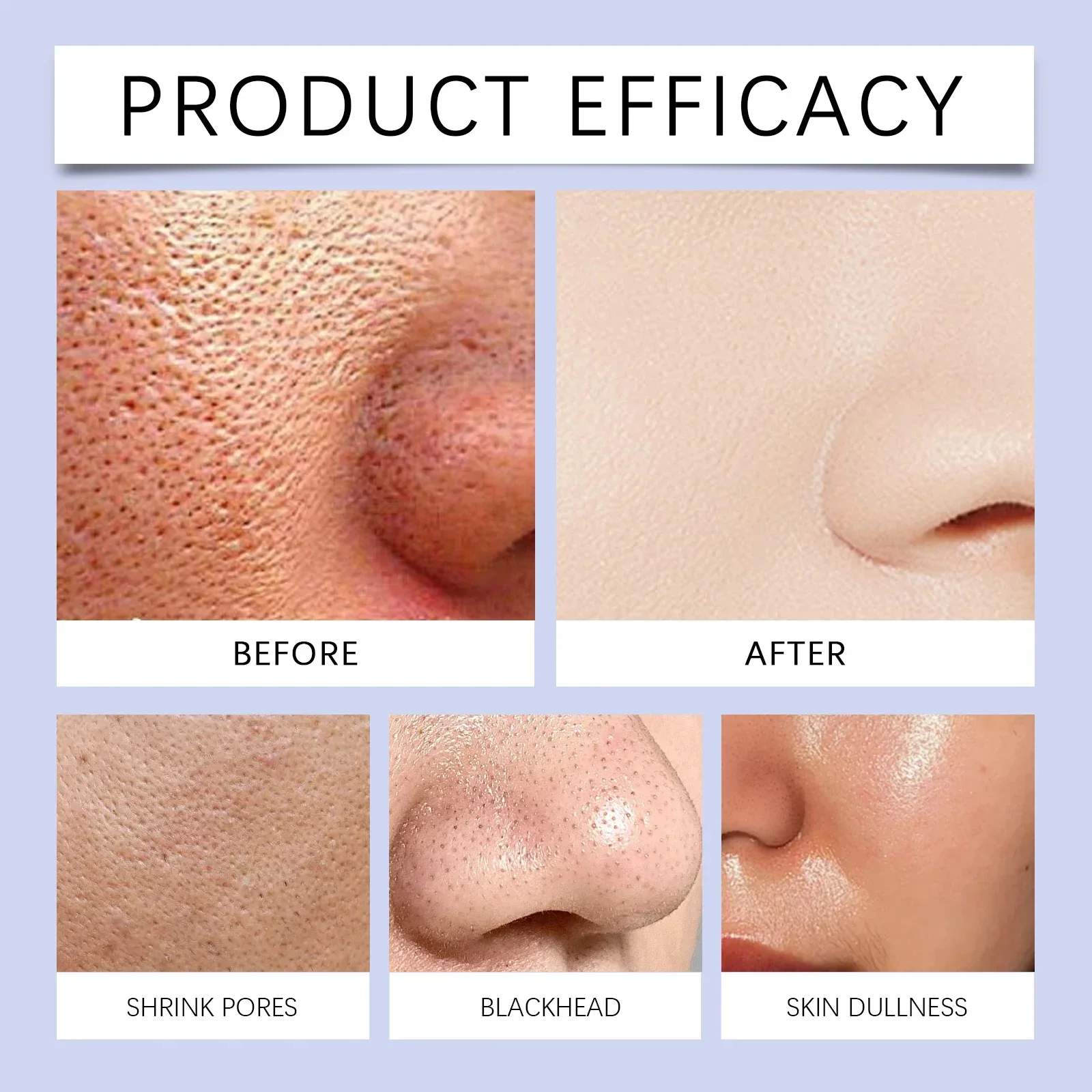Facial Essence Microneedle Shrink Pores Whitening Lifting Firm Fine Line Serum Moisturise Melanin Remove Skin Care Product