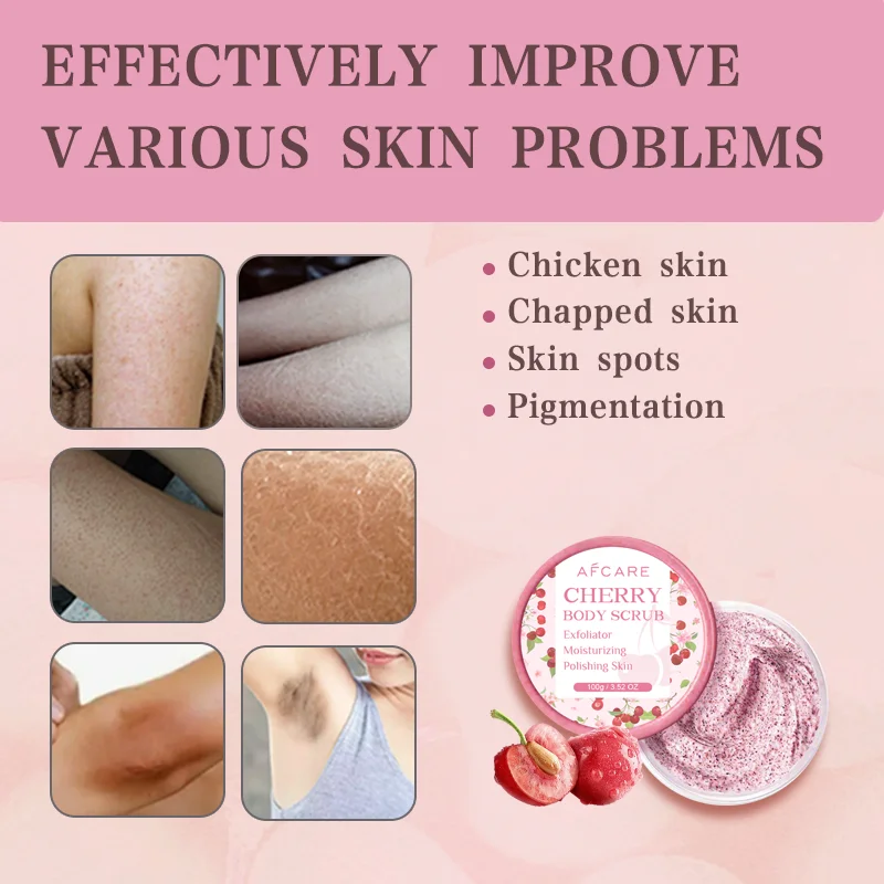 Cherry Body Scrub Exfoliator Deep Cleaning Moisturizing Niacinamide Whitening Improve Cracked Chicken Skin Exfoliating Cream 5