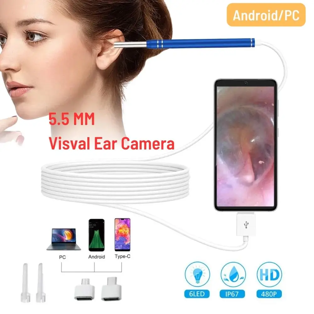 Endoscope d'oreille visuel HD, Kanoscope vétérinaire USB, livres  d'avertissement d'oreille, inspection Kanoscopio, outils pour téléphone  Android et PC, 5.5mm, 3 en 1