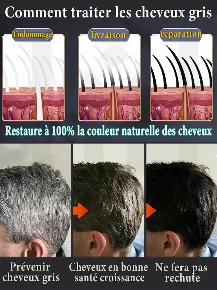 Cabelo branco, resolvendo o problema do cabelo branco, restaurando a cor natural do cabelo