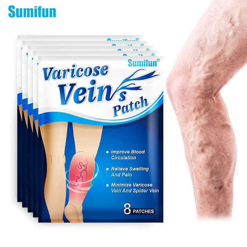 8 шт. пластырь от варикозного расширения вен | Красота и здоровье