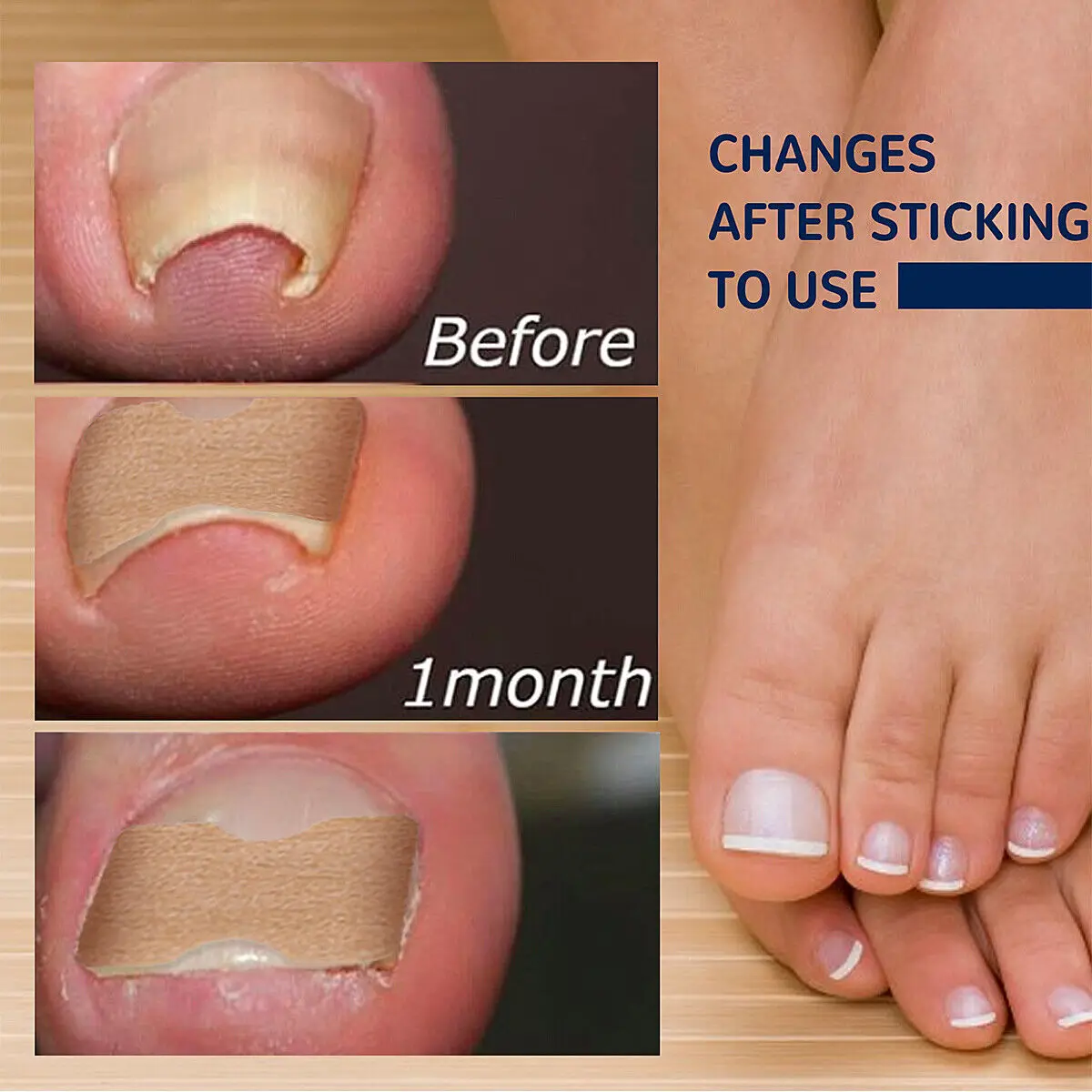 120pcs Ingrown Toenail Correction Stickers Foot Care