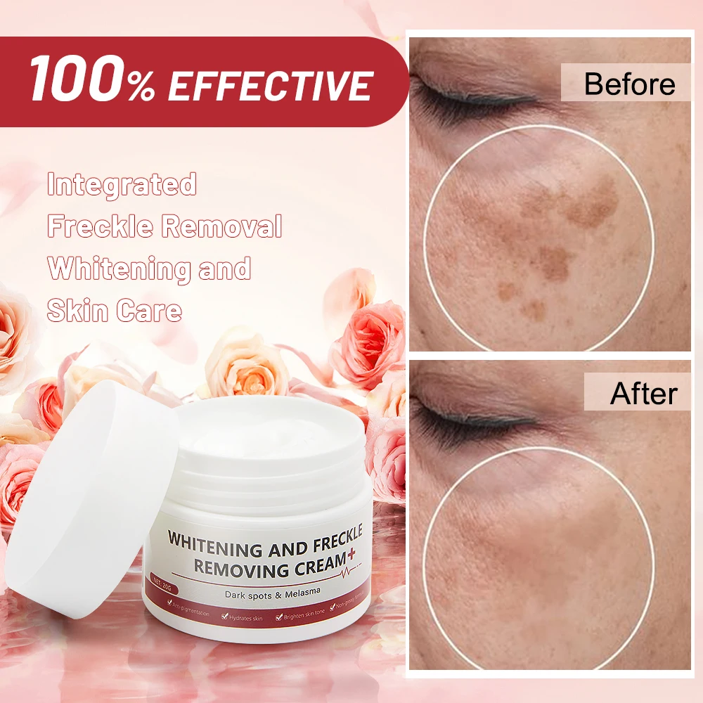 Whitening Cream 7-day rapid freckle removal