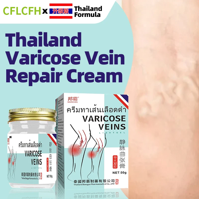 

Varicose Veins Cream Thailand Formula Vasculitis Phlebitis Spider Legs Treatment Angiitis Leg Dilated Relief Medicine Foot Care