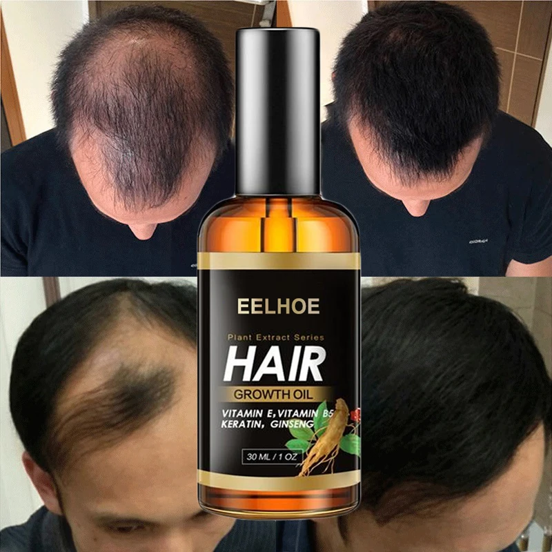 Ginseng Hair Growth Nutrient Solution Hair Loss Treatment Fast Activate Hair Follicles Hair Care
