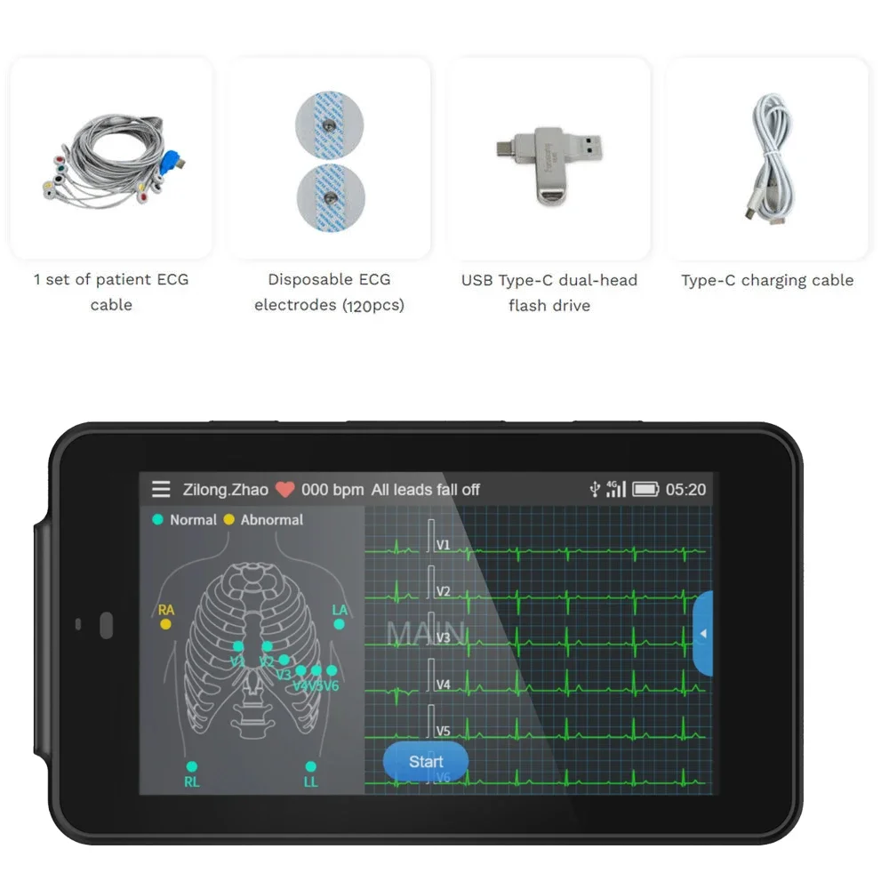 Charge 12-Lead ECG Machine 24-hour Handheld ECG Machine Glasgow Data Analysis Report Adults & Pediatrics Cardiologists