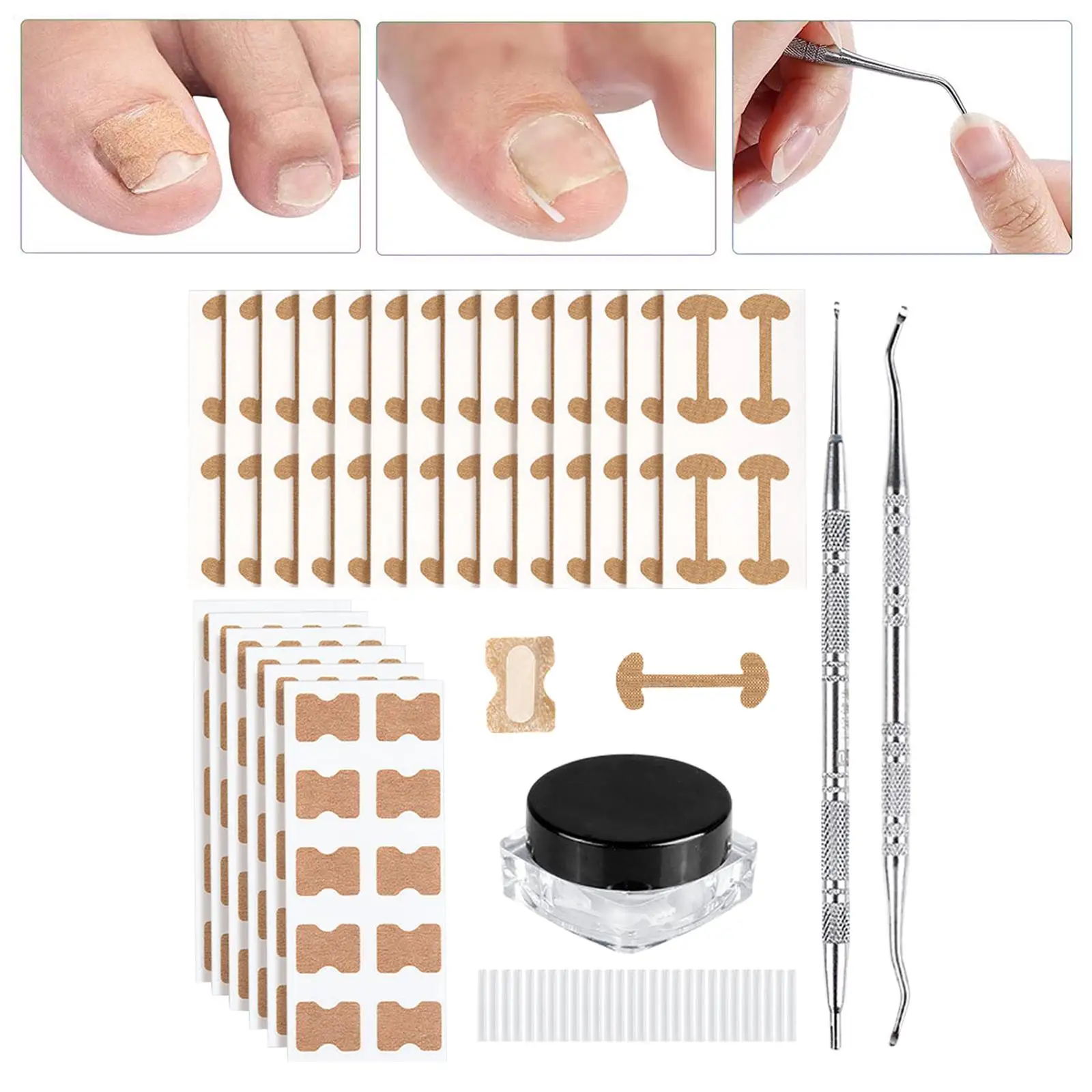 

Elastic Ingrown Toenail Corrector Stickers Toenail Patch for Pedicure Tools
