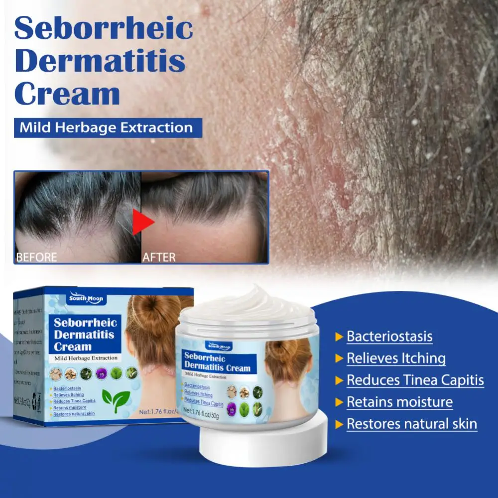Hot 50g/box Itchy Skin Cream Nonirritating Healthy Safe Effective Anti