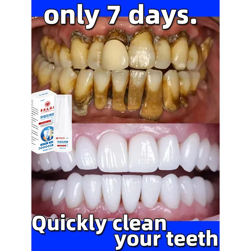 Dental Calculus Remover Teeth Whitening Spray Toothpaste Cleaning Oral Hygiene Removal Halitosis Plaque Stains Fresh Breath Care teeth whitening product teeth whitening essence dental calculus remover teeth health product