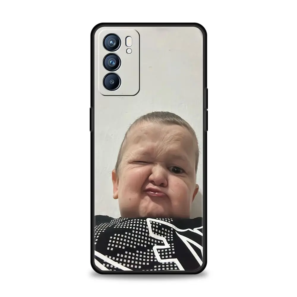 Humorous Hasbulla Phone Case - Stylish and Durable Cover