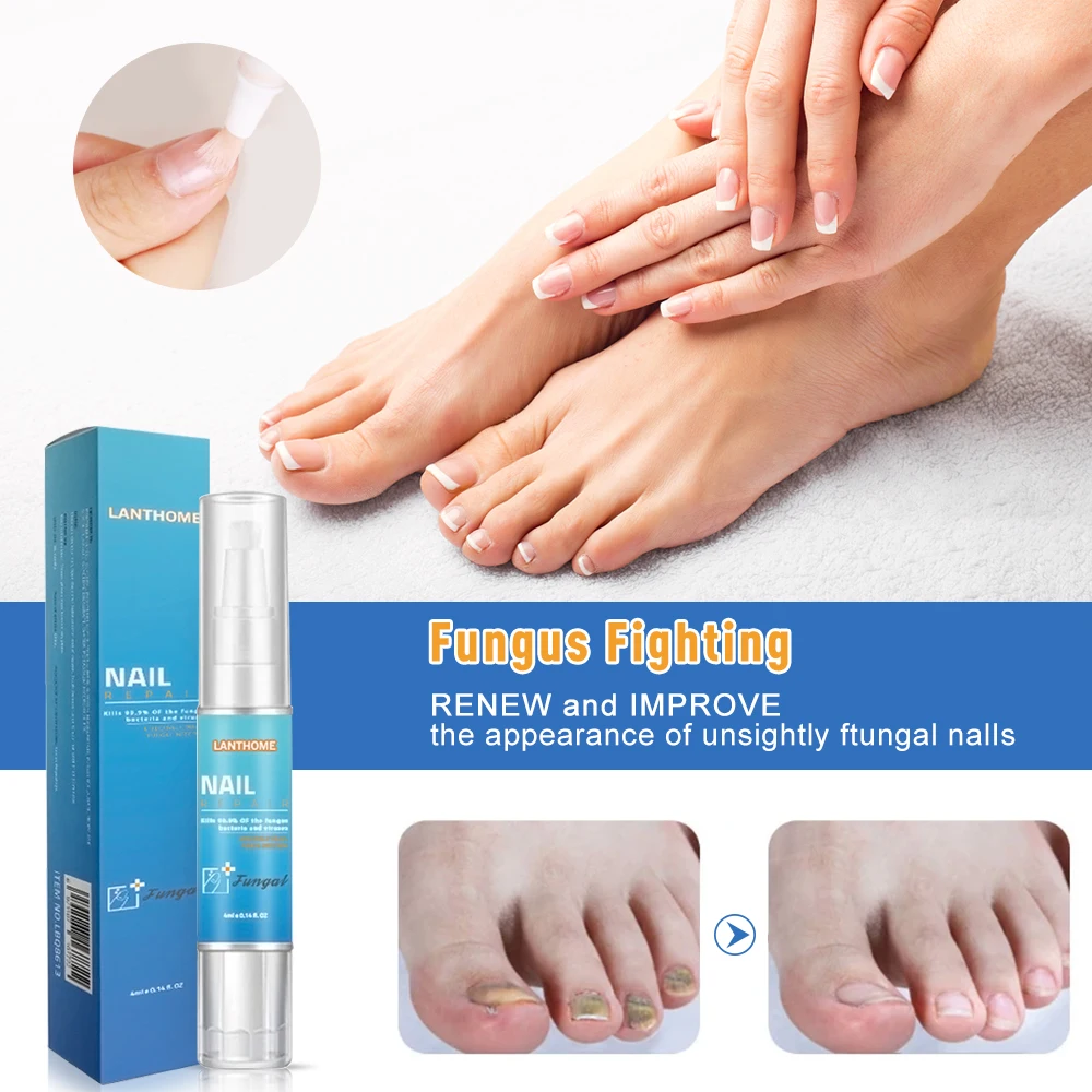 Fungal Nail Treatment Pen Onychomycosis Paronychia Antifungal Serum