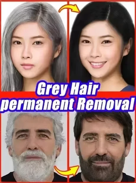 Hair Coloring Product Remove Gray Hair and Restore Natural Color in 7 Days