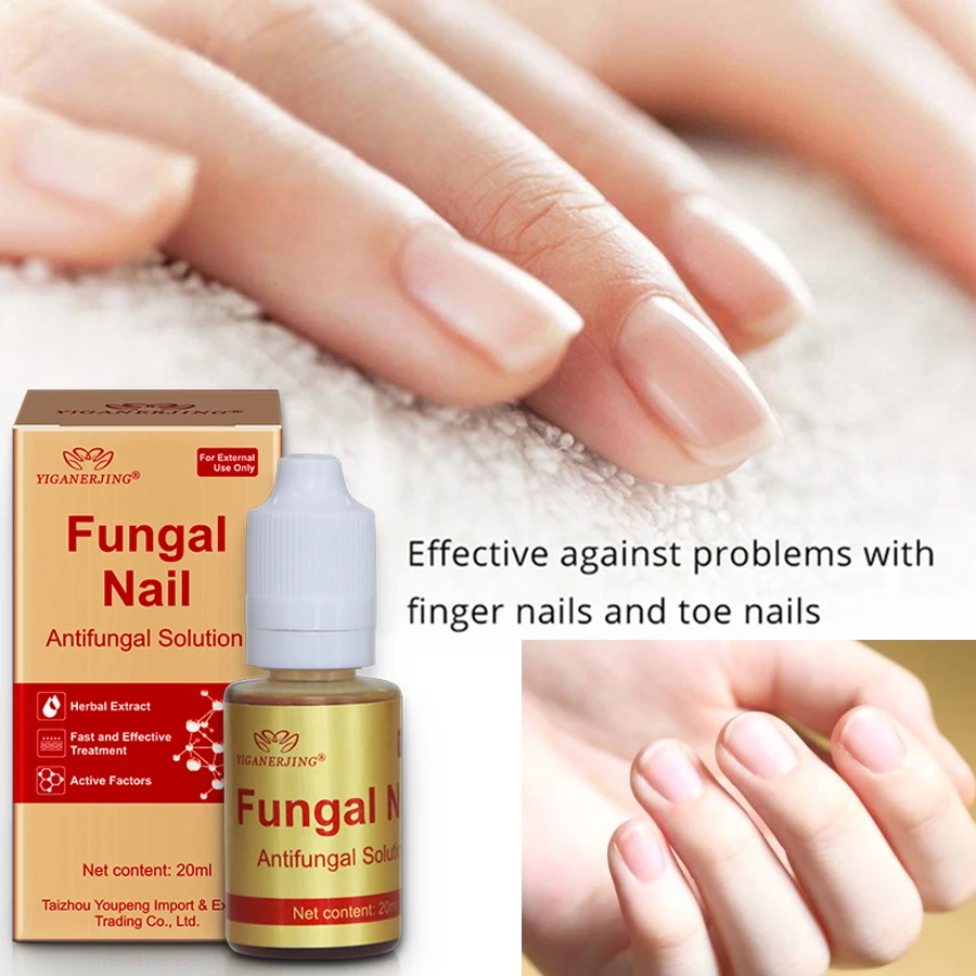 

10pcs YIGANERJING Fungal Nail Care Antifungal Solution For Paronychia Toe Nail Fungus Treatment 20ML