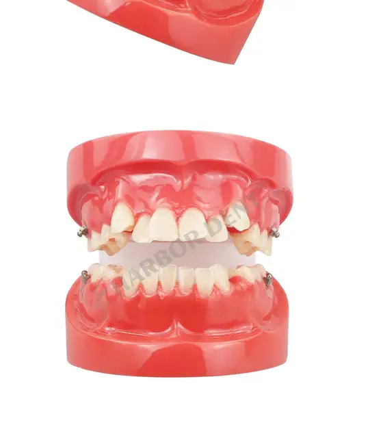 Modello Con Vallo Di Occlusione In Resina | GF Dental - Foto 6