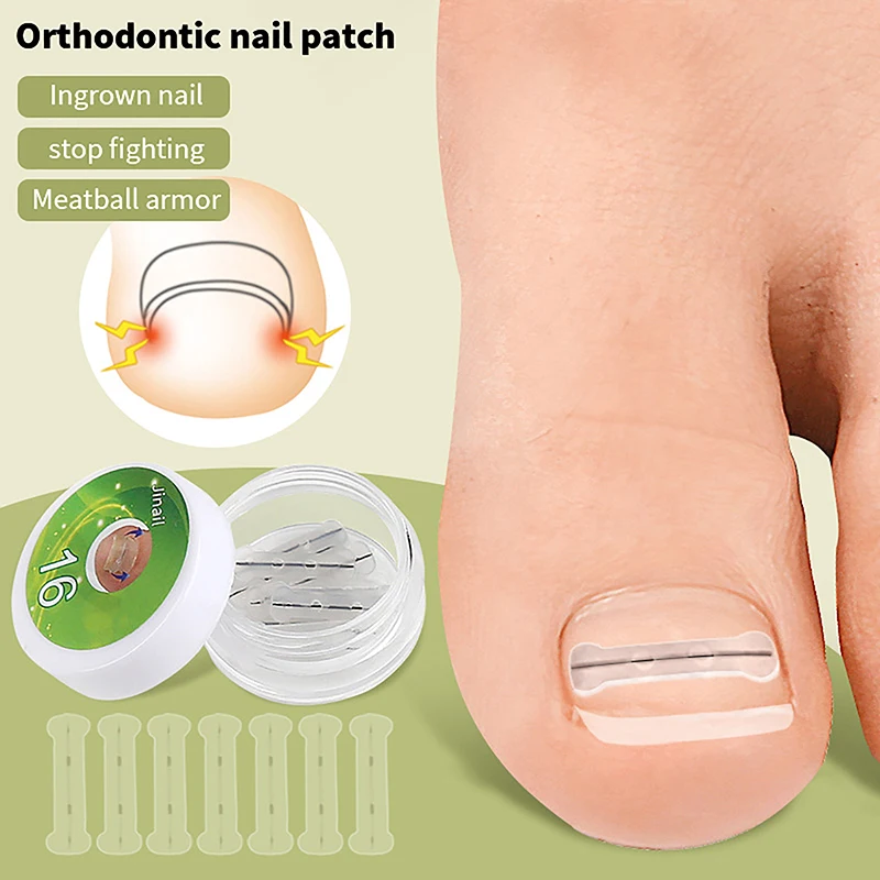 10pcs Ingrown Toenail Correction Tool Ingrown Toe Nail Treatment Elastic Patch Sticker Straightening Clip Brace Pedicure Tool radiator brush straightening cleaner condenser ac coil metal fin comb air conditioner tool