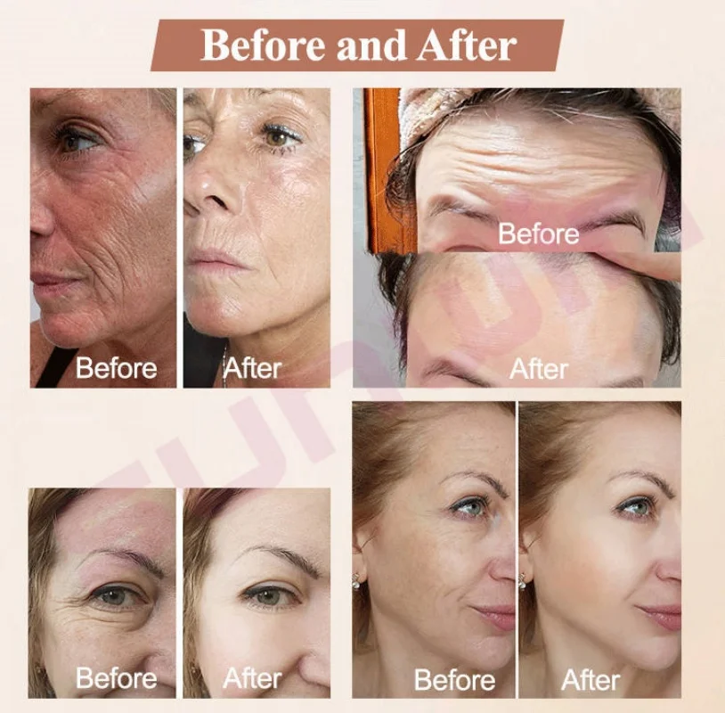 Latest Ems+RF Desktop Electromagnetic Peface Device Skin Tightening Skin Rejuvenation Ems Sculpting Rf Facical Beauty Machine