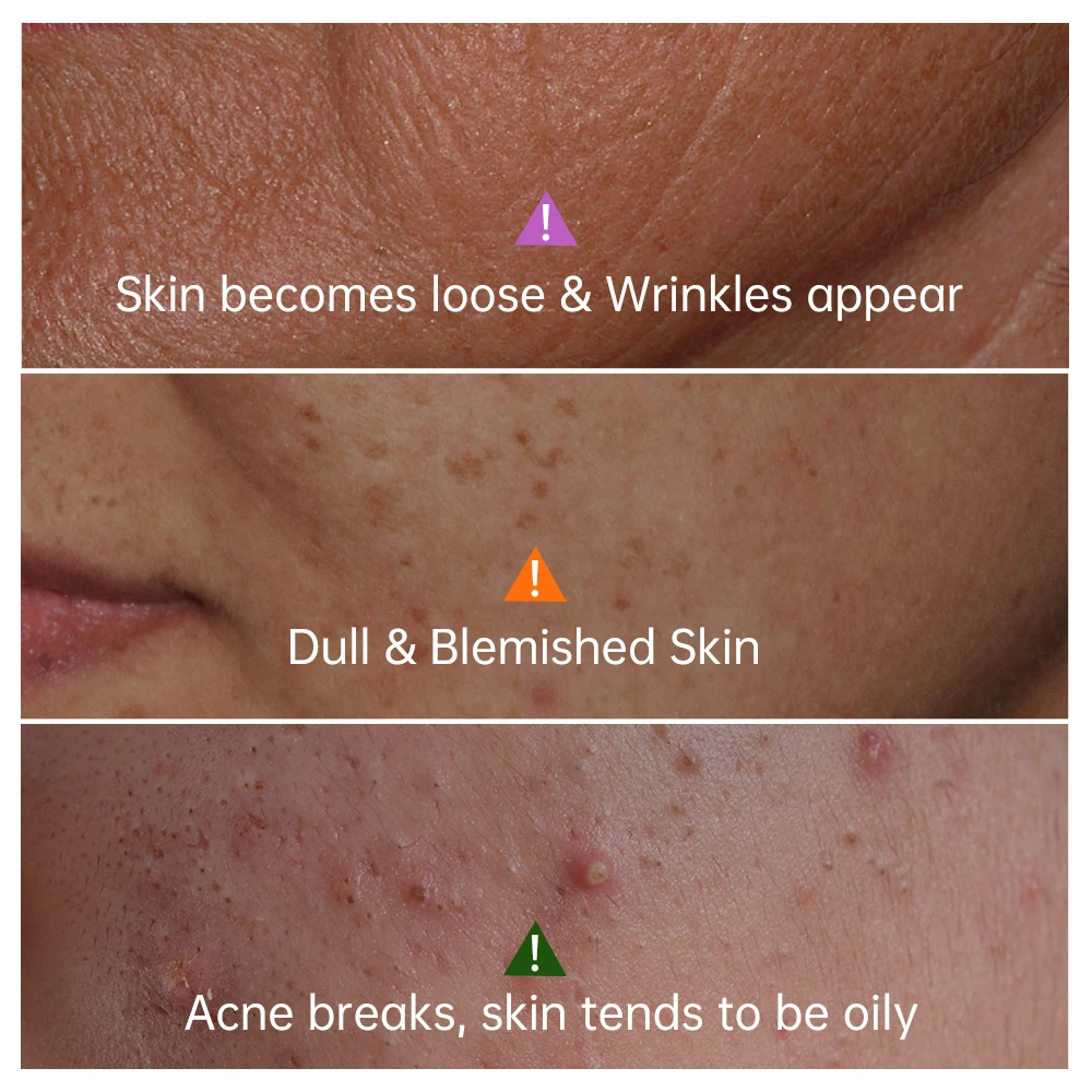 JoyPretty Vitamin C Collagen Face Serum Dark Spots Remover Anti Aging Pore Shrink Moisturizing Serum Facial Skin Care Cosmetics 2