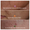 JoyPretty Vitamin C Collagen Face Serum Dark Spots Remover Anti Aging Pore Shrink Moisturizing Serum Facial Skin Care Cosmetics 2