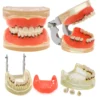 Dental Teeth Model  Dentist Teaching Model Demonstration Periodontal Disease Pathological For Patient Education Demo M4017 1