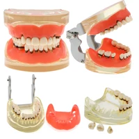 Dental Teeth Model  Dentist Teaching Model Demonstration Periodontal Disease Pathological For Patient Education Demo M4017 1