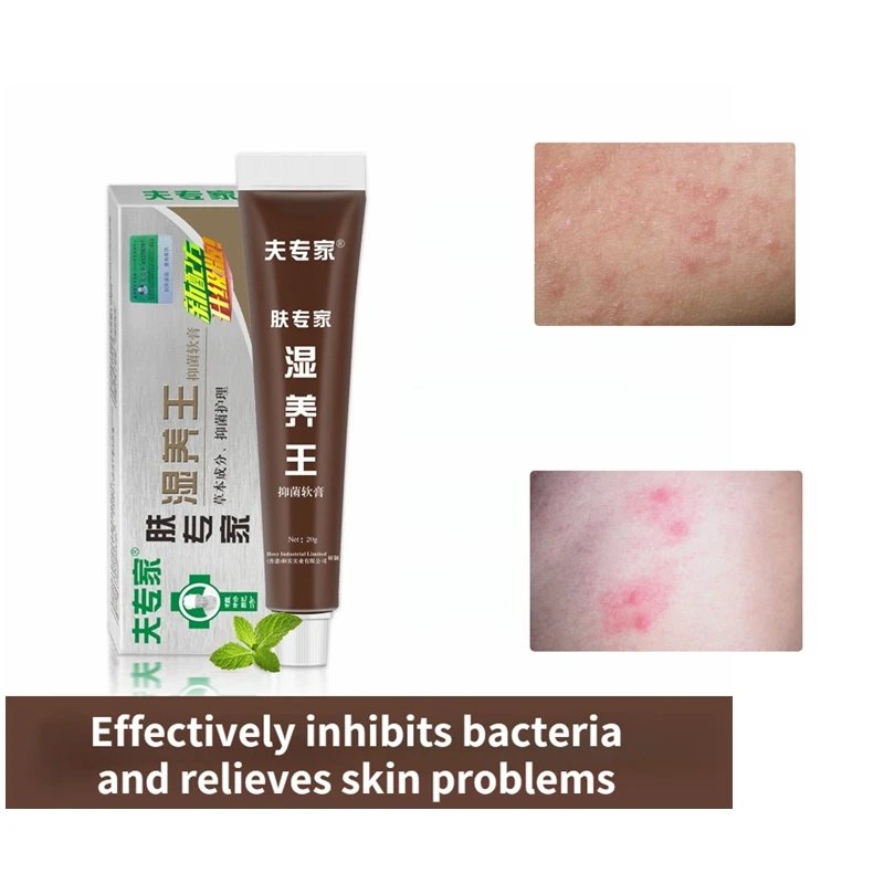 

Skin Dermatitis Eczema Cream Treatment Psoriasis Cream Skin Cream Buttock Itching Pubic Dermatitis Mosquito Bites Ointment