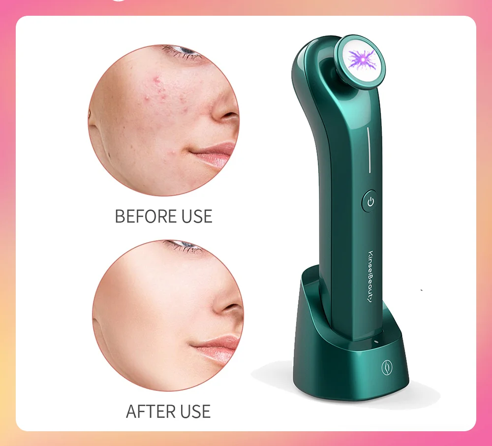 Plasma Skin Care Ozone Therapy  Acne Remove Anti-acne Sterilization Facial Massager Eye Face Lifting Anti Wrinkle Beauty Device pet cats weaning sterilization clothes small dog kitten anti lick vest cat surgery recovery clothing for wounds or skin disease