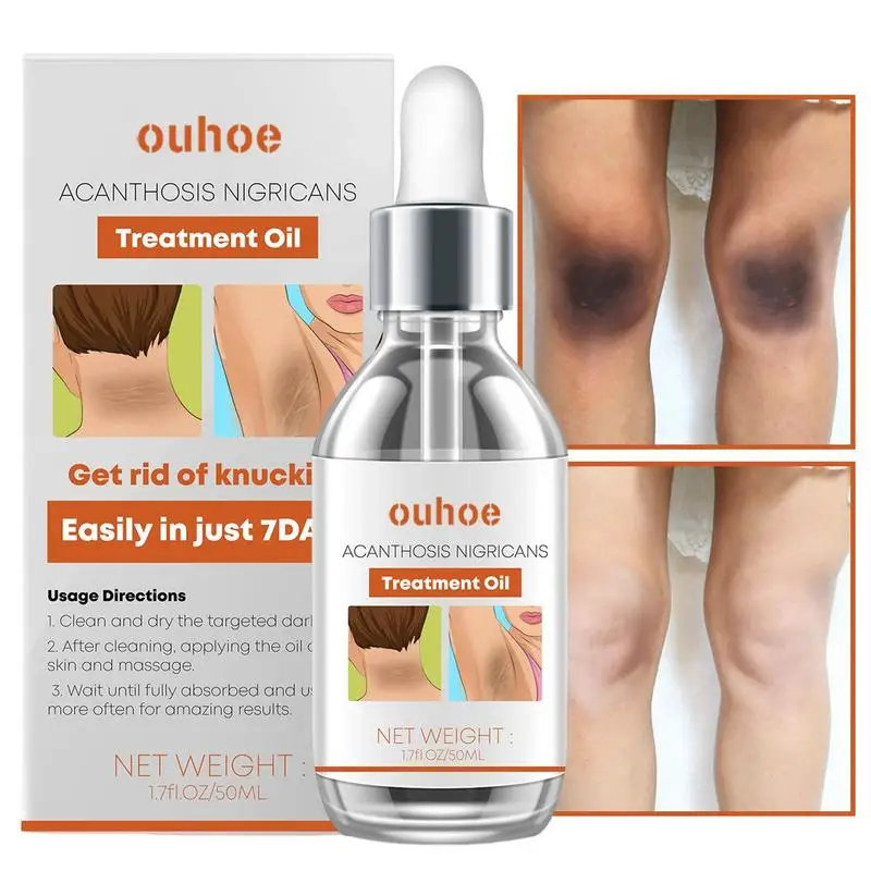 Dark Spots Corrector Underarm Legs Knee Cream Therapy Essence For