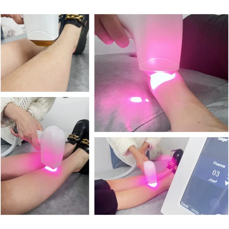 Diode Laser Hair Removal Machine 3 Wavelength 755 1064 808nm Laser Ice Platinum Permanent Painless Hair Removal Alexandrit CE 6