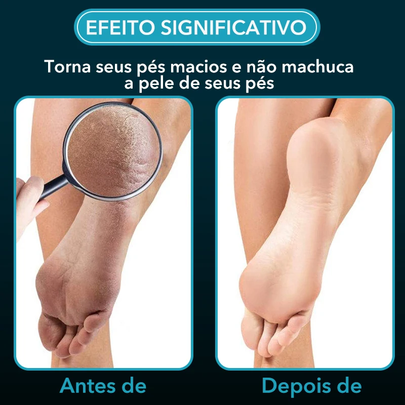 Nano Glass Foot Rasp Heel File Hard Dead Skin Callus Remover Exfoliating  Pedicure Care Foot File Tool - AliExpress