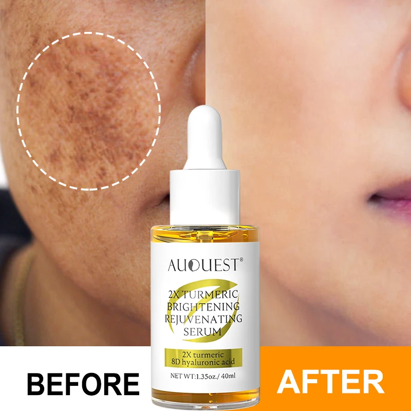 Turmeric Dark Spot Remover Face Serum 1