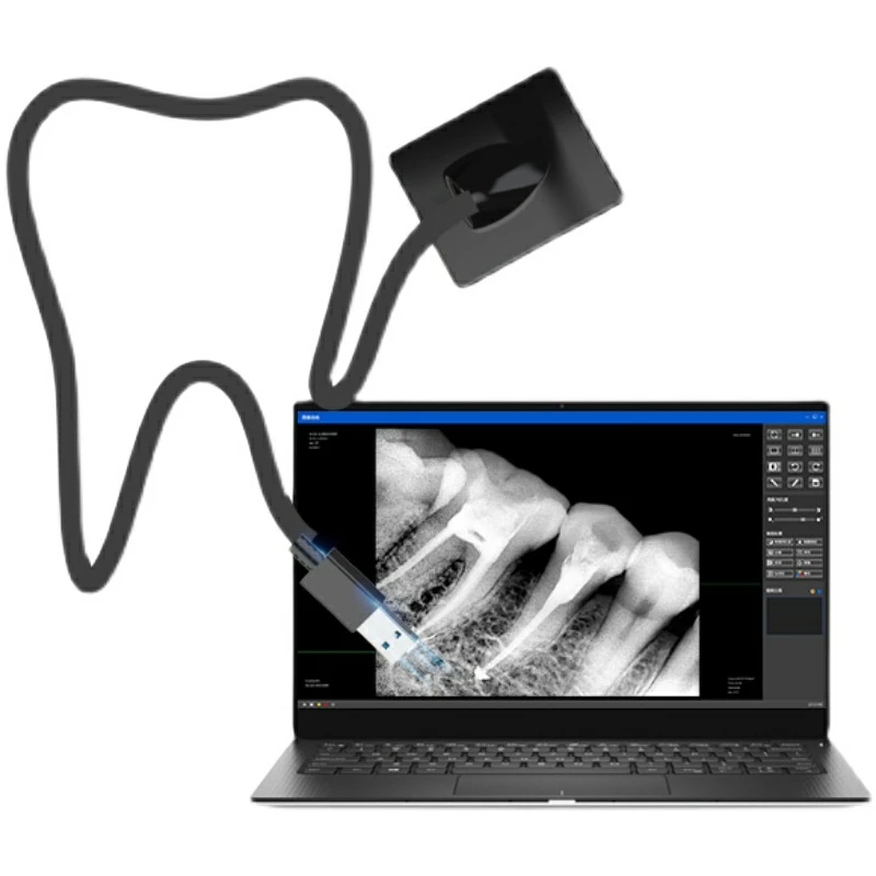 Size2DentalxraysensorDirectImagingDigitalDentalIntraoralXray