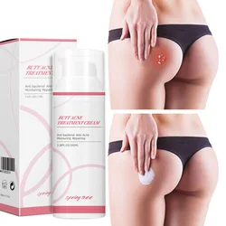 100ml Hip and buttocks acne cream whitening without mark fade the mark of acne moisturizing soothing non irritating