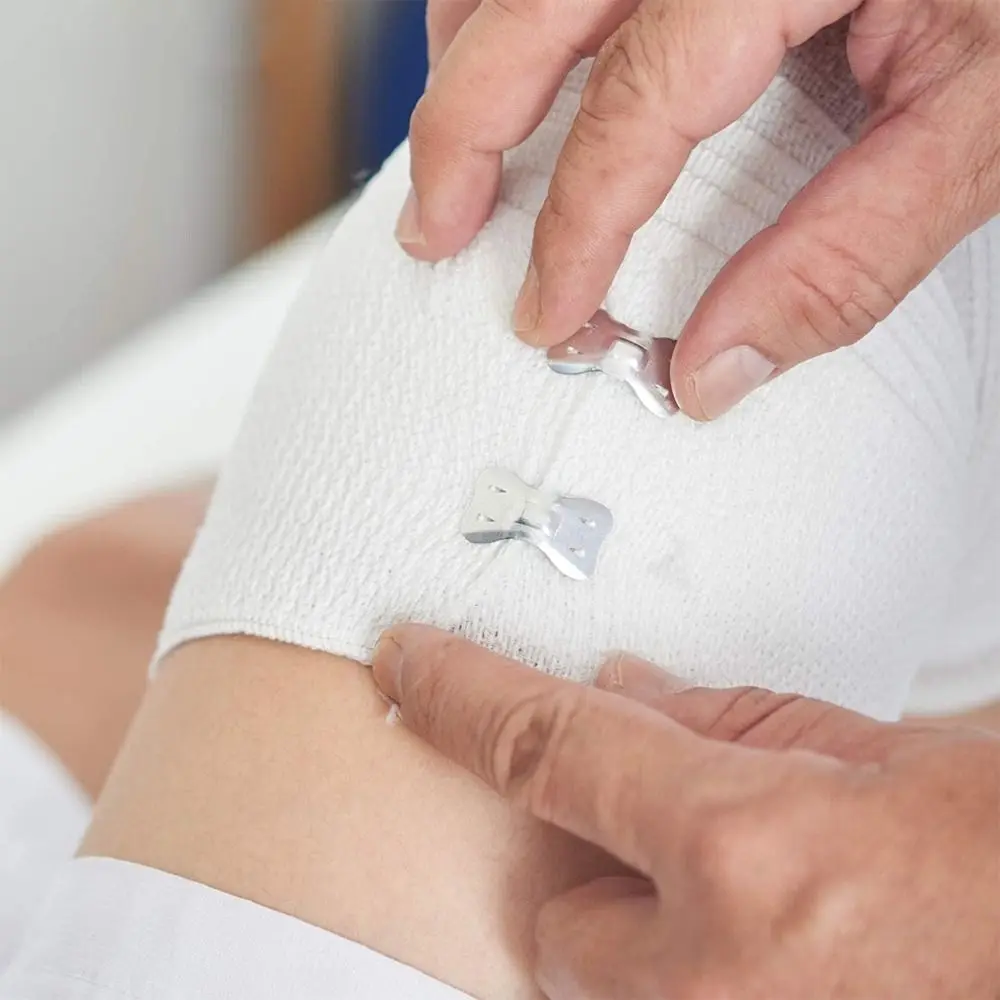 10PCS 알루미늄 폴리 에스터 탄력 붕대 클립 화이트 브라운 실버 탄력 붕대 교체 클립 교체 가능