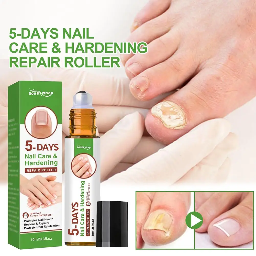 Nail Growth And Hardening Repair Roller Nail Repair Thickening Solution Brightening Removing Nutrient Soft N1W6 5 Days nail fungus remover manicure pedicure tools